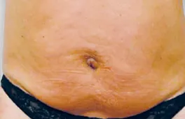 Belmed Esthetics